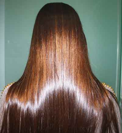 Image Title My Image